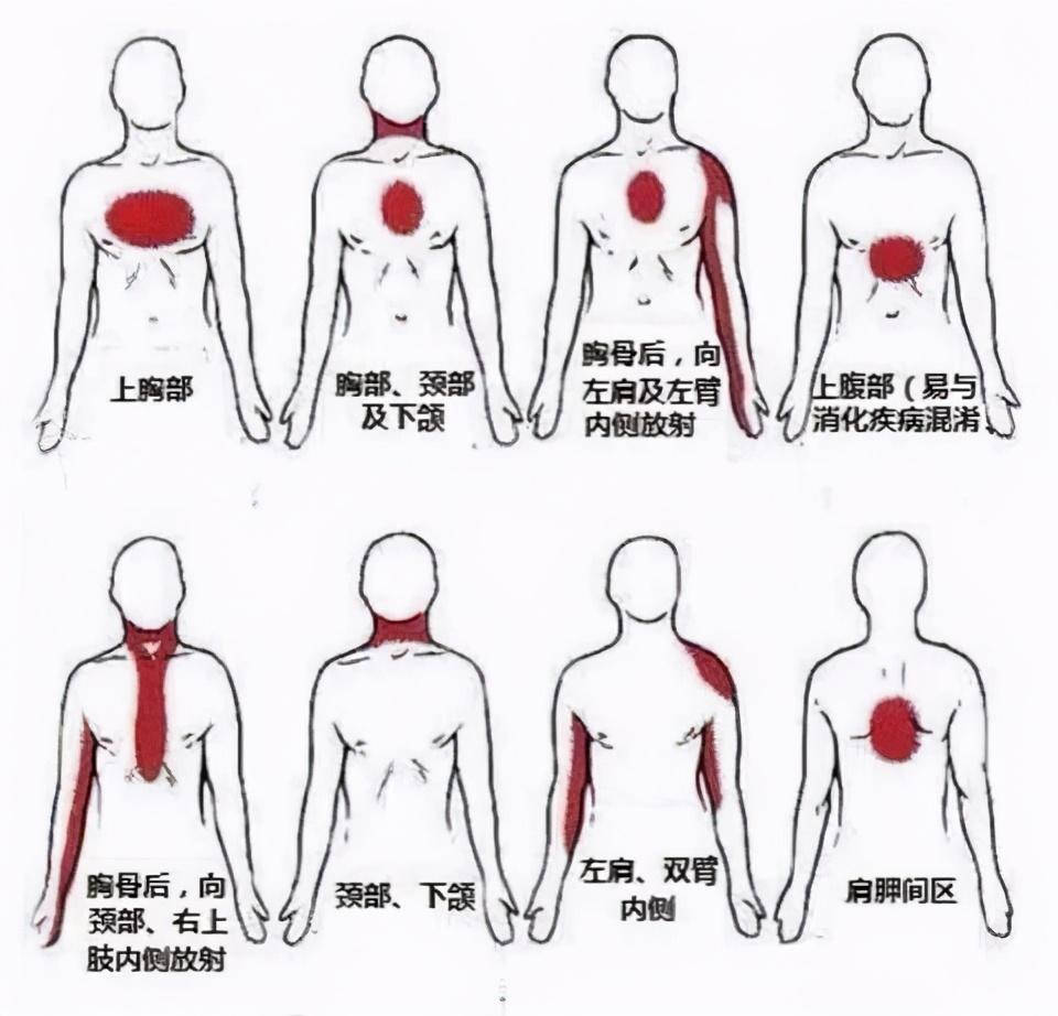 90后女子背疼9分钟完成心梗自救，一场与时间赛跑的奇迹