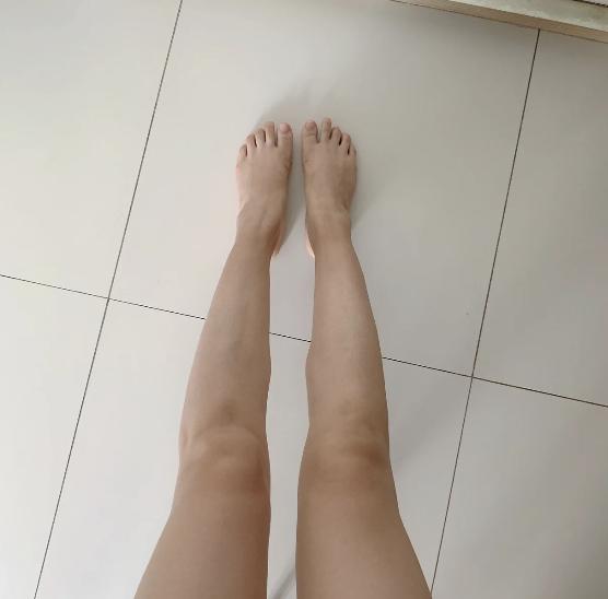 拇外翻的健康教育，预防、管理与生活品质提升