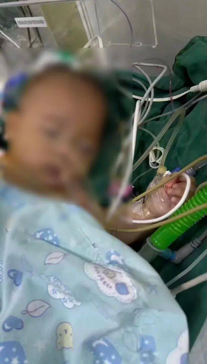 卫健局紧急回应，女婴意外被秤砣砸中事件引发社会广泛关注