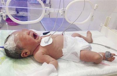 出生4天的女婴遭遇不幸，三次被秤砣砸中后尿血