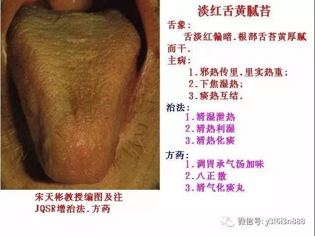 中医舌诊，透视健康的微妙窗口